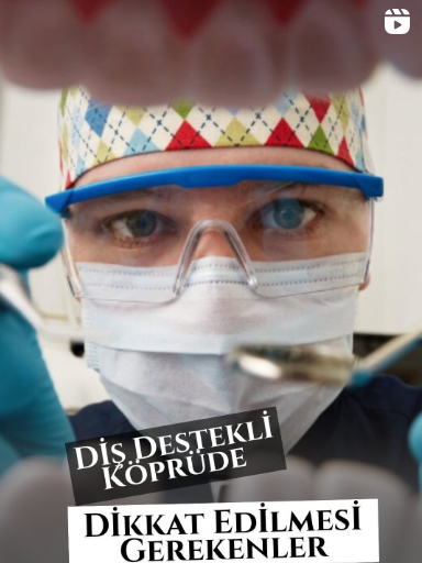 Instagram Reels Görseli