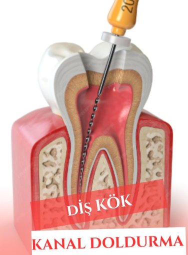 Instagram Reels Görseli