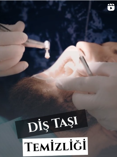 Instagram Reels Görseli