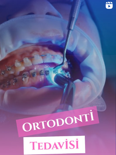 Instagram Reels Görseli