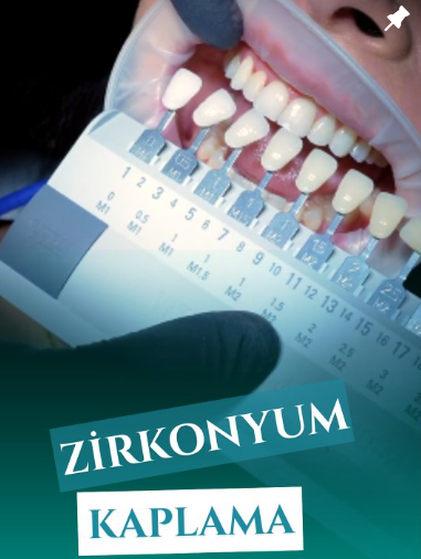 Instagram Reels Görseli