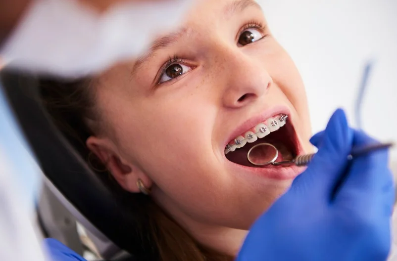Ortodonti Tedavisi